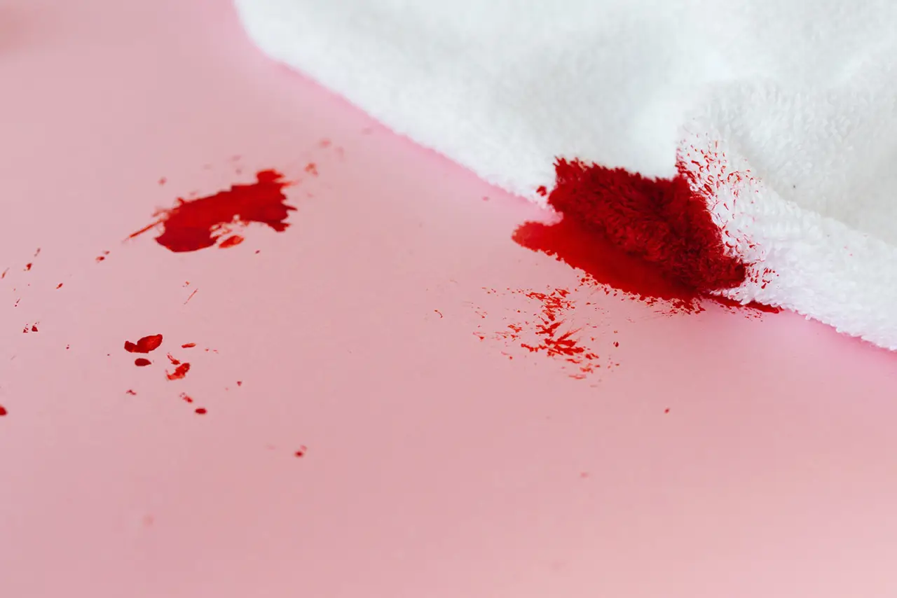 Rimuovere le macchie di sangue dai tessuti chiari: ecco cosa funziona davvero Rimuovere le macchie di sangue dai tessuti chiari: ecco cosa funziona davvero